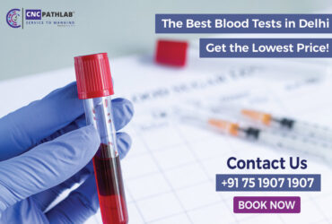 The Best Blood Tests in Delhi: Get the Lowest Price!