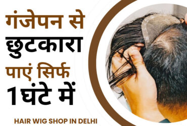 Hair Wig Shop in Delhi – Get rid of baldness in just 1 hour