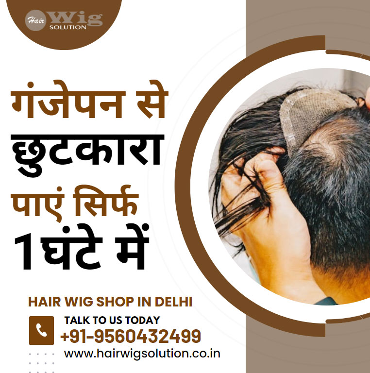 Hair Wig Shop in Delhi – Get rid of baldness in just 1 hour