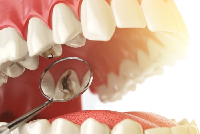 Best Dental Hospital in Bangalore | Ridgetop Dental International