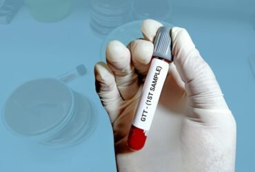 hba1c test price in delhi