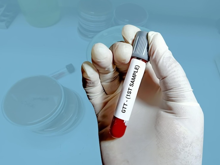 hba1c test price in delhi