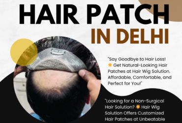 Affordable Hair Patch in Delhi – Hair Wig Solution